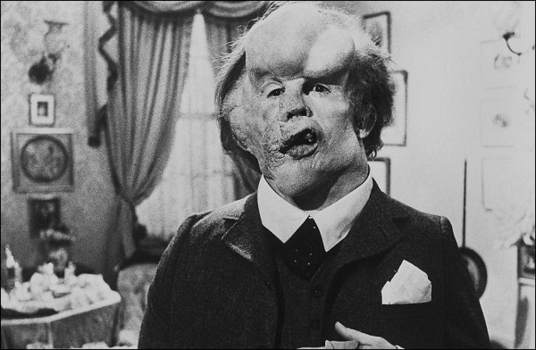 Le comédien John Hurt (Elephant Man, Harry Potter) est décédé